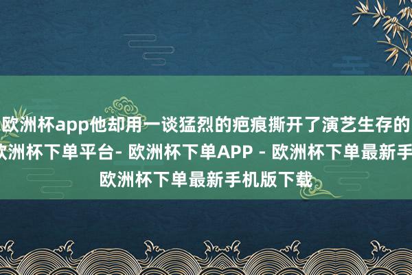 欧洲杯app他却用一谈猛烈的疤痕撕开了演艺生存的新篇章-欧洲杯下单平台- 欧洲杯下单APP - 欧洲杯下单最新手机版下载